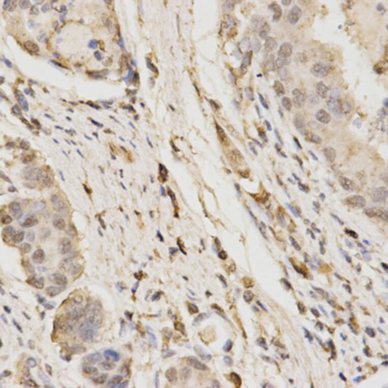 Immunohistochemistry - GLB1 Antibody from Signalway Antibody (32478) - Antibodies.com