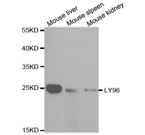 Western blot - LY96 Antibody from Signalway Antibody (32480) - Antibodies.com
