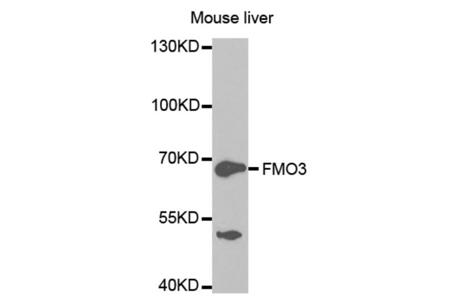 Western blot - FMO3 Antibody from Signalway Antibody (32491) - Antibodies.com