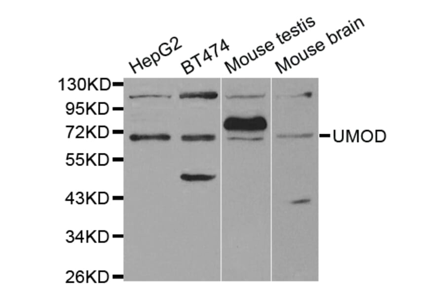 Western blot - UMOD Antibody from Signalway Antibody (32498) - Antibodies.com