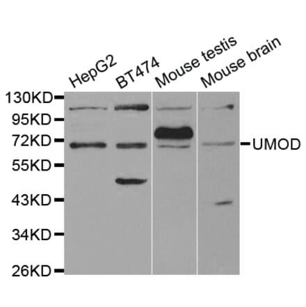 Western blot - UMOD Antibody from Signalway Antibody (32498) - Antibodies.com