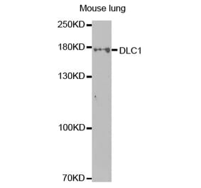 Western blot - DLC1 Antibody from Signalway Antibody (32499) - Antibodies.com