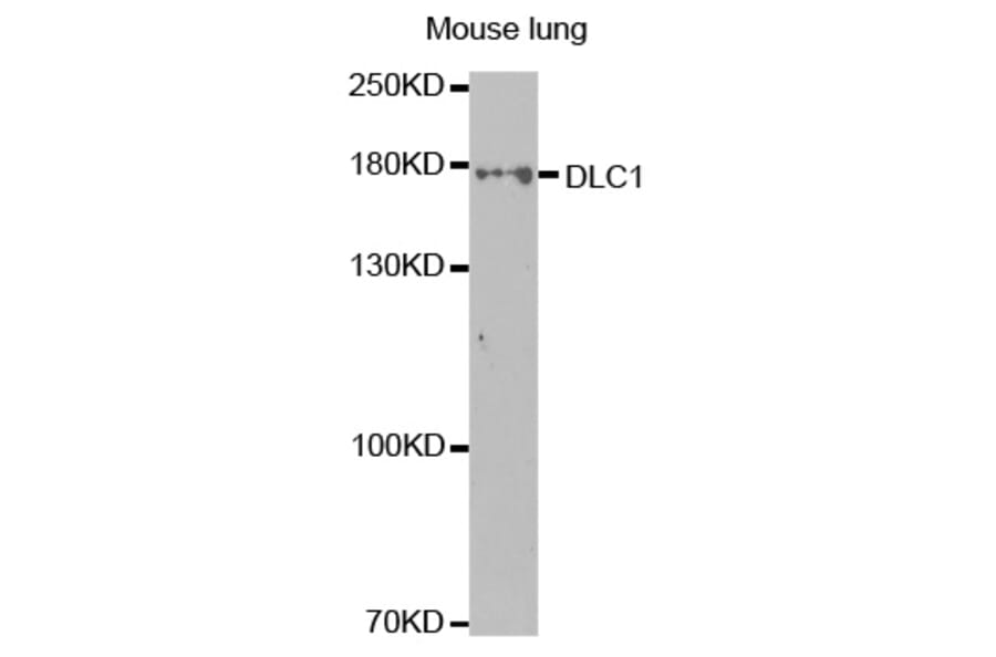 Western blot - DLC1 Antibody from Signalway Antibody (32499) - Antibodies.com