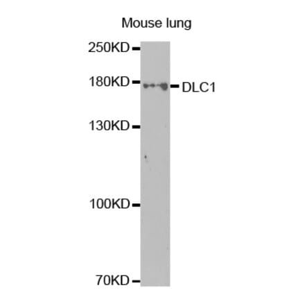 Western blot - DLC1 Antibody from Signalway Antibody (32499) - Antibodies.com