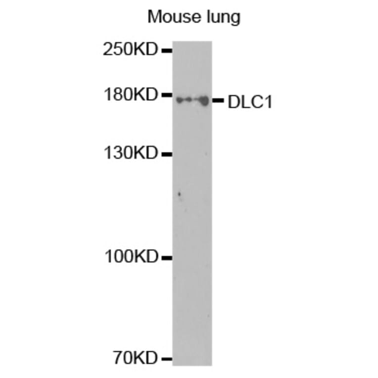Western blot - DLC1 Antibody from Signalway Antibody (32499) - Antibodies.com