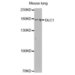 Western blot - DLC1 Antibody from Signalway Antibody (32499) - Antibodies.com