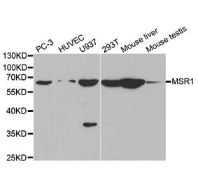 Western blot - MSR1 Antibody from Signalway Antibody (32500) - Antibodies.com