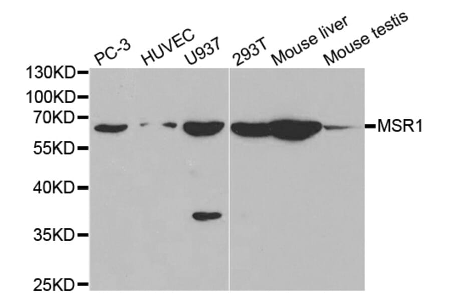 Western blot - MSR1 Antibody from Signalway Antibody (32500) - Antibodies.com
