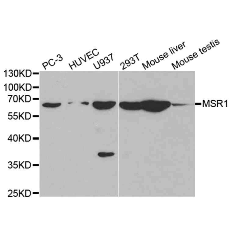 Western blot - MSR1 Antibody from Signalway Antibody (32500) - Antibodies.com