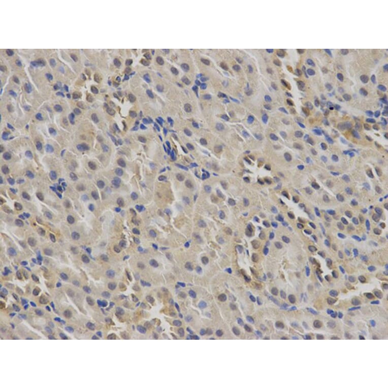 Immunohistochemistry - MSR1 Antibody from Signalway Antibody (32500) - Antibodies.com