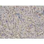 Immunohistochemistry - MSR1 Antibody from Signalway Antibody (32500) - Antibodies.com