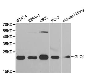 Western blot - GLO1 Antibody from Signalway Antibody (32505) - Antibodies.com