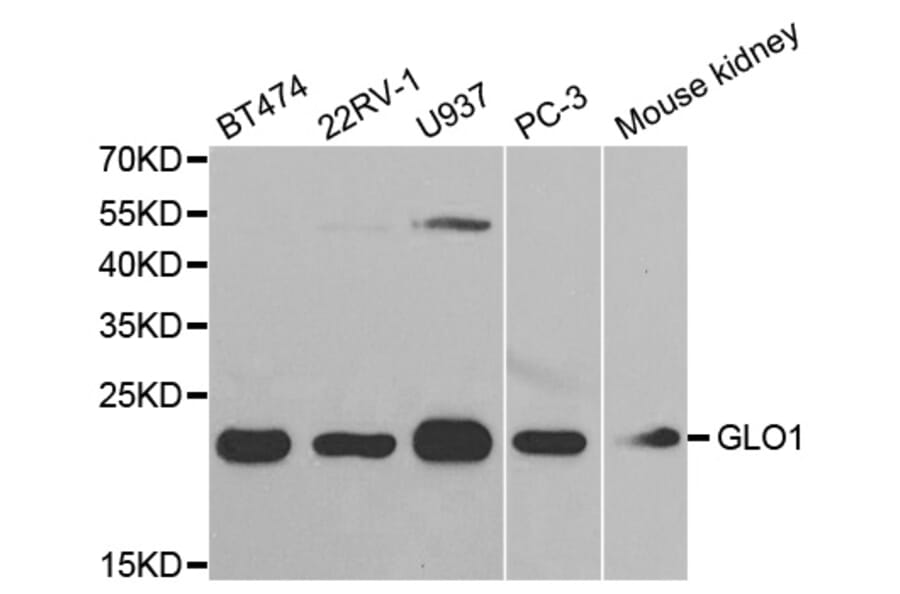 Western blot - GLO1 Antibody from Signalway Antibody (32505) - Antibodies.com