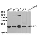 Western blot - GLO1 Antibody from Signalway Antibody (32505) - Antibodies.com