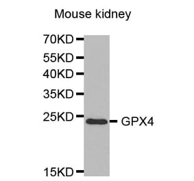Western blot - GPX4 Antibody from Signalway Antibody (32506) - Antibodies.com
