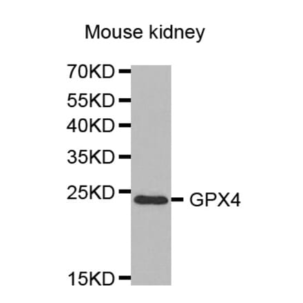 Western blot - GPX4 Antibody from Signalway Antibody (32506) - Antibodies.com