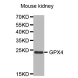 Western blot - GPX4 Antibody from Signalway Antibody (32506) - Antibodies.com