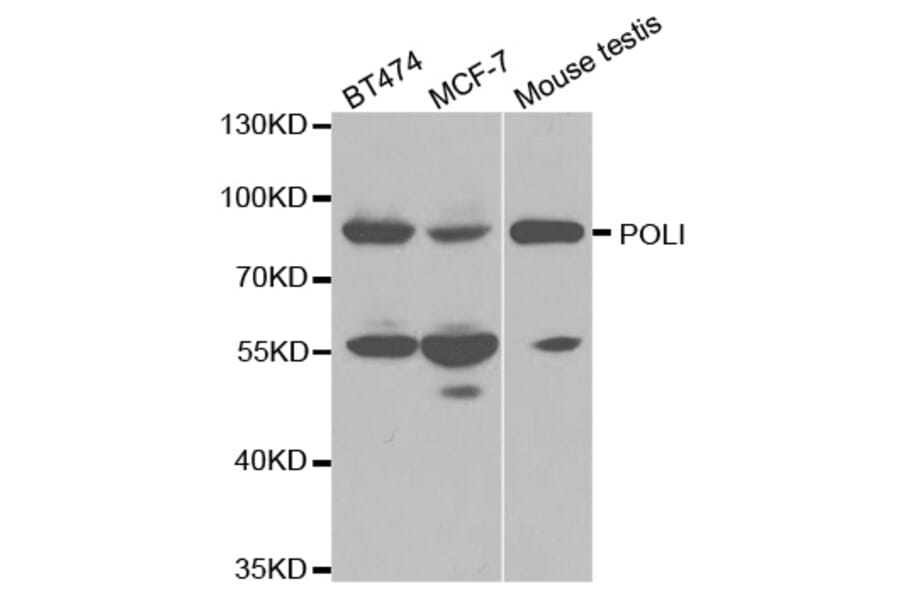 Western blot - POLI Antibody from Signalway Antibody (32510) - Antibodies.com