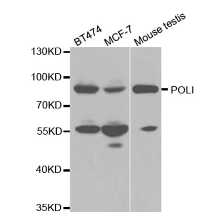 Western blot - POLI Antibody from Signalway Antibody (32510) - Antibodies.com