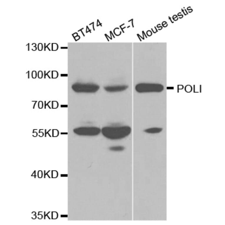 Western blot - POLI Antibody from Signalway Antibody (32510) - Antibodies.com