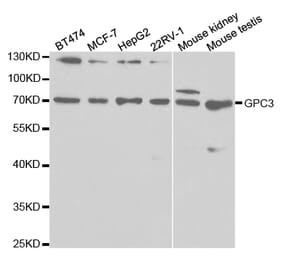 Western blot - GPC3 Antibody from Signalway Antibody (32513) - Antibodies.com