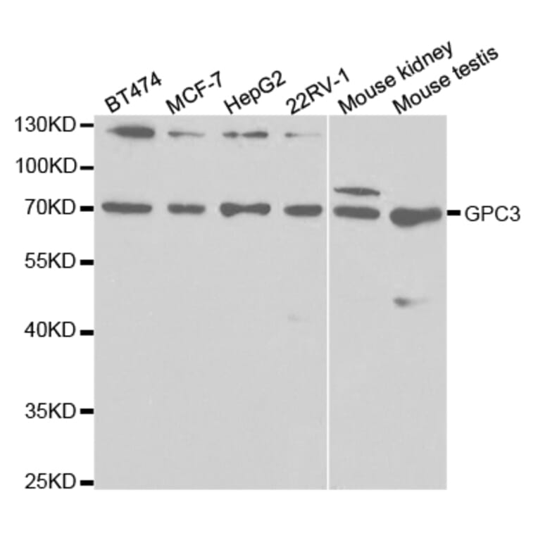 Western blot - GPC3 Antibody from Signalway Antibody (32513) - Antibodies.com