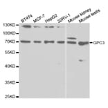 Western blot - GPC3 Antibody from Signalway Antibody (32513) - Antibodies.com