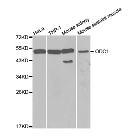 Western blot - ODC1 Antibody from Signalway Antibody (32515) - Antibodies.com