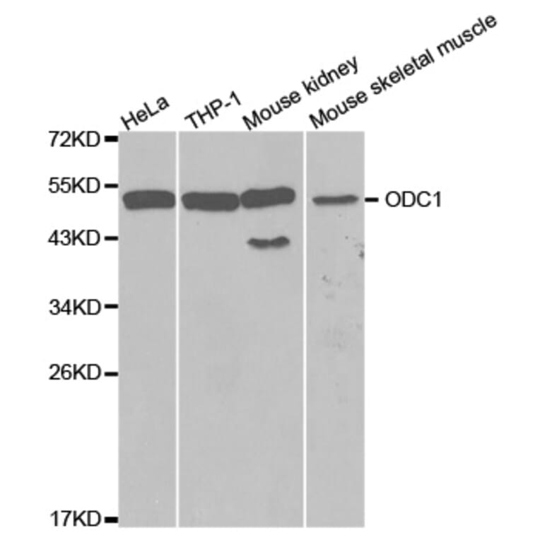 Western blot - ODC1 Antibody from Signalway Antibody (32515) - Antibodies.com