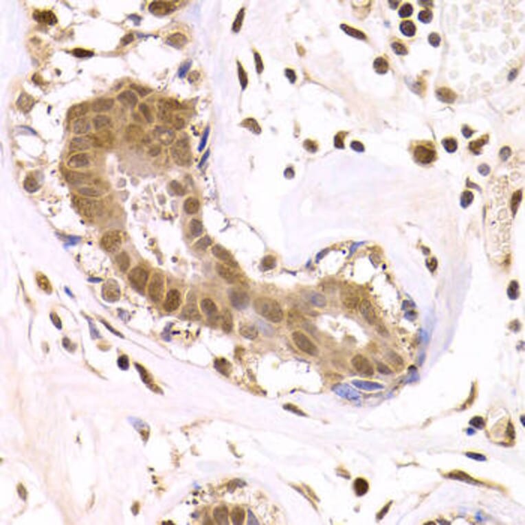 Immunohistochemistry - ODC1 Antibody from Signalway Antibody (32515) - Antibodies.com