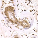 Immunohistochemistry - ODC1 Antibody from Signalway Antibody (32515) - Antibodies.com