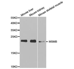 Western blot - MSMB Antibody from Signalway Antibody (32522) - Antibodies.com