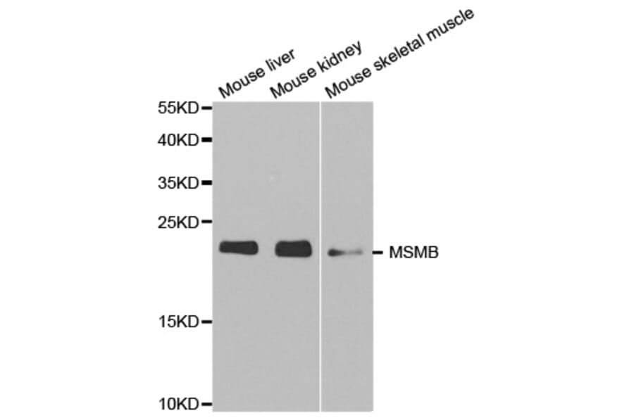Western blot - MSMB Antibody from Signalway Antibody (32522) - Antibodies.com