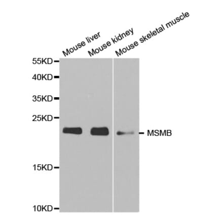 Western blot - MSMB Antibody from Signalway Antibody (32522) - Antibodies.com