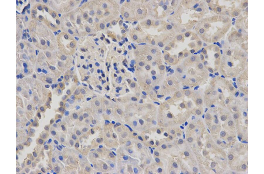 Immunohistochemistry - MSMB Antibody from Signalway Antibody (32522) - Antibodies.com