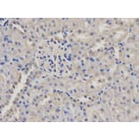 Immunohistochemistry - MSMB Antibody from Signalway Antibody (32522) - Antibodies.com