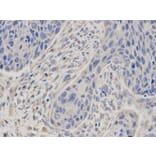 Immunohistochemistry - MSMB Antibody from Signalway Antibody (32522) - Antibodies.com