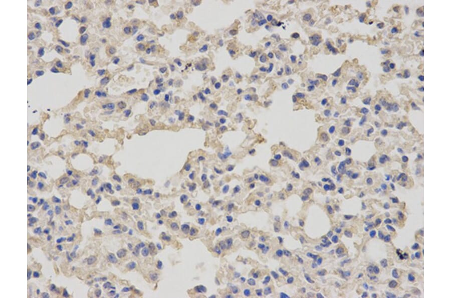 Immunohistochemistry - MSMB Antibody from Signalway Antibody (32522) - Antibodies.com