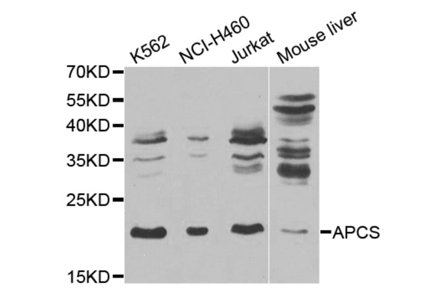 Western blot - APCS Antibody from Signalway Antibody (32543) - Antibodies.com