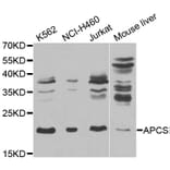 Western blot - APCS Antibody from Signalway Antibody (32543) - Antibodies.com