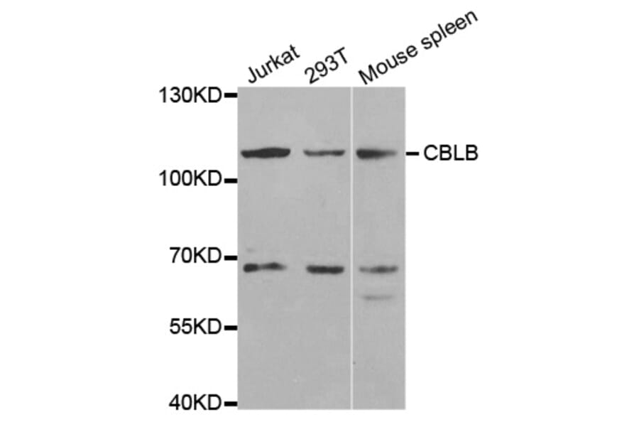 Western blot - CBLB Antibody from Signalway Antibody (32551) - Antibodies.com