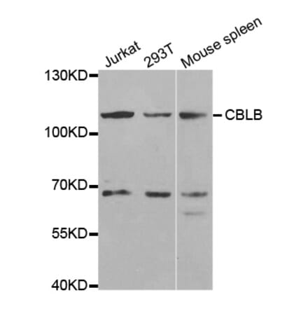 Western blot - CBLB Antibody from Signalway Antibody (32551) - Antibodies.com