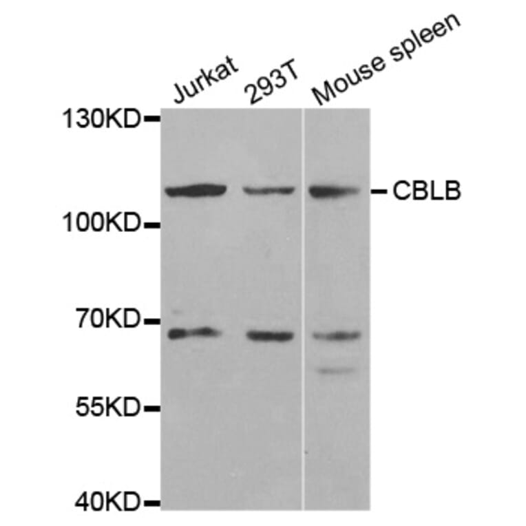 Western blot - CBLB Antibody from Signalway Antibody (32551) - Antibodies.com