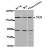 Western blot - CBLB Antibody from Signalway Antibody (32551) - Antibodies.com