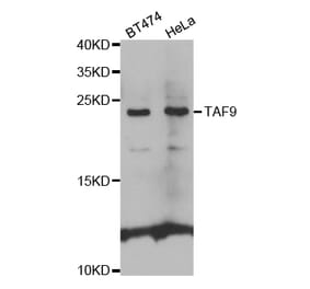 Western blot - TAF9 Antibody from Signalway Antibody (32554) - Antibodies.com