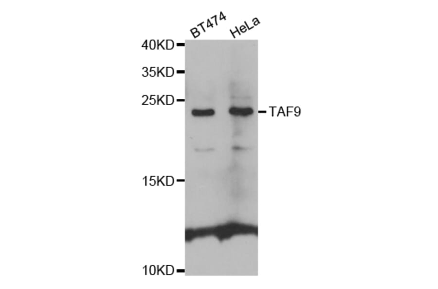 Western blot - TAF9 Antibody from Signalway Antibody (32554) - Antibodies.com