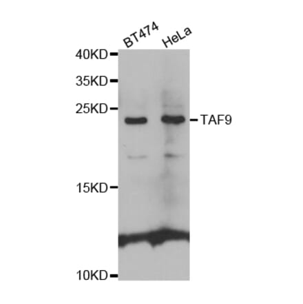 Western blot - TAF9 Antibody from Signalway Antibody (32554) - Antibodies.com