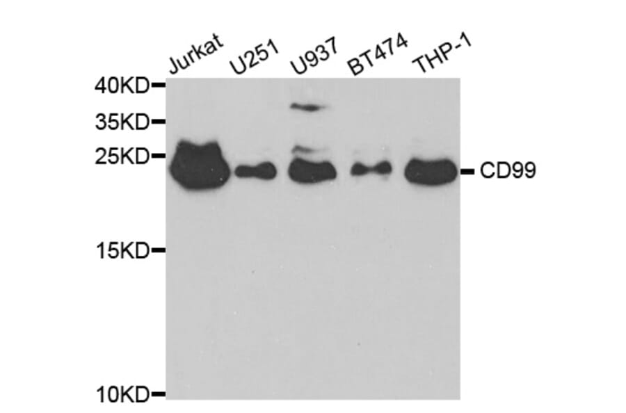 Western blot - CD99 Antibody from Signalway Antibody (32558) - Antibodies.com