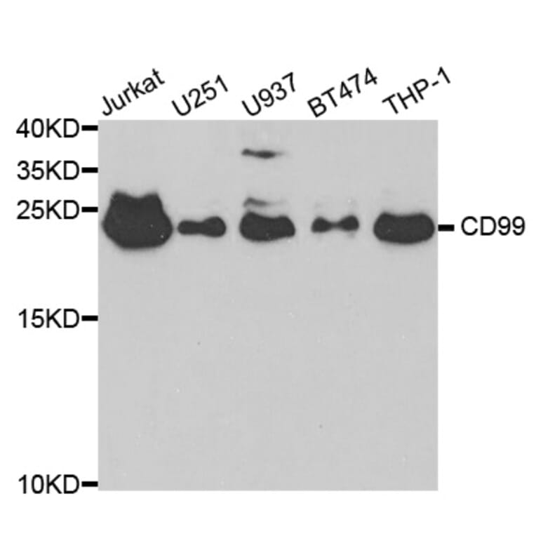 Western blot - CD99 Antibody from Signalway Antibody (32558) - Antibodies.com