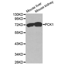 Western blot - PCK1 Antibody from Signalway Antibody (32565) - Antibodies.com